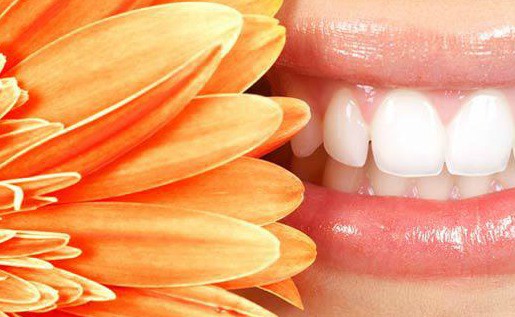 tratamientos de estética dental