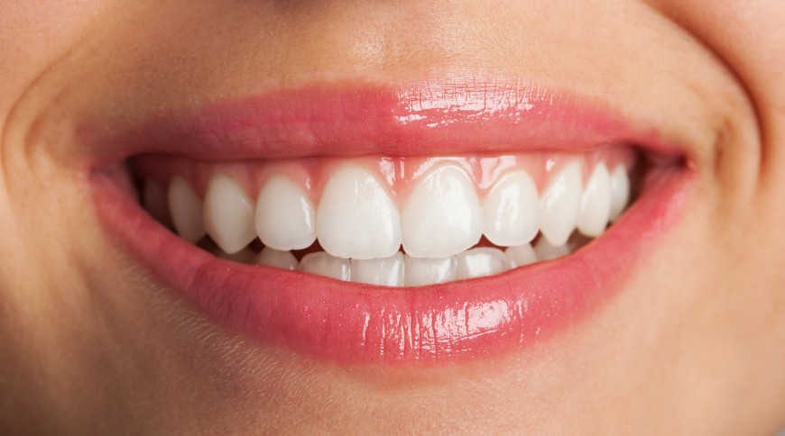 Qué es Invisalign ® y cómo funciona? Precios y resultados – Clínica dental  MADO