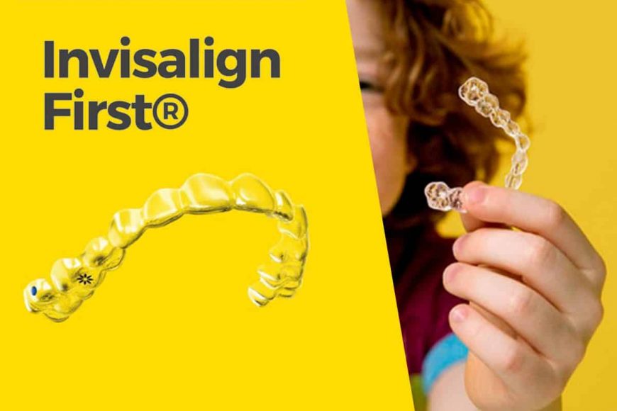 invisalign-first-albalat-dental